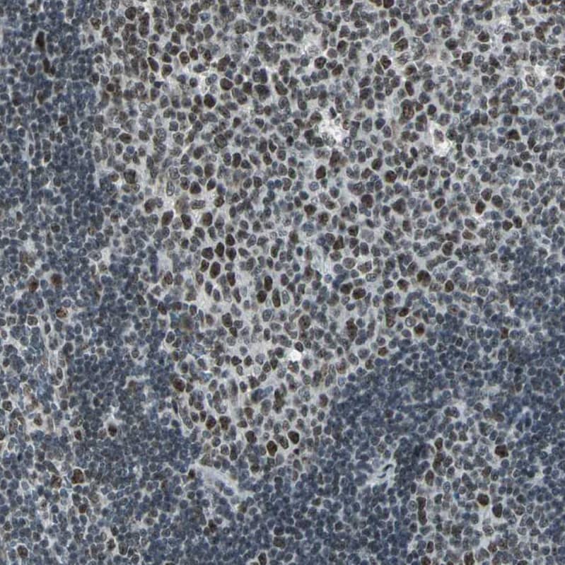 CBX3 Antibody - BSA Free Immunohistochemistry-Paraffin: CBX3 Antibody - BSA Free [NBP1-83228]