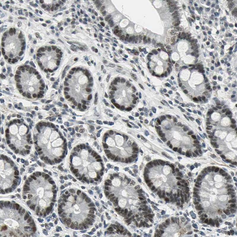 CBX3 Antibody - BSA Free Immunohistochemistry-Paraffin: CBX3 Antibody - BSA Free [NBP1-83228]