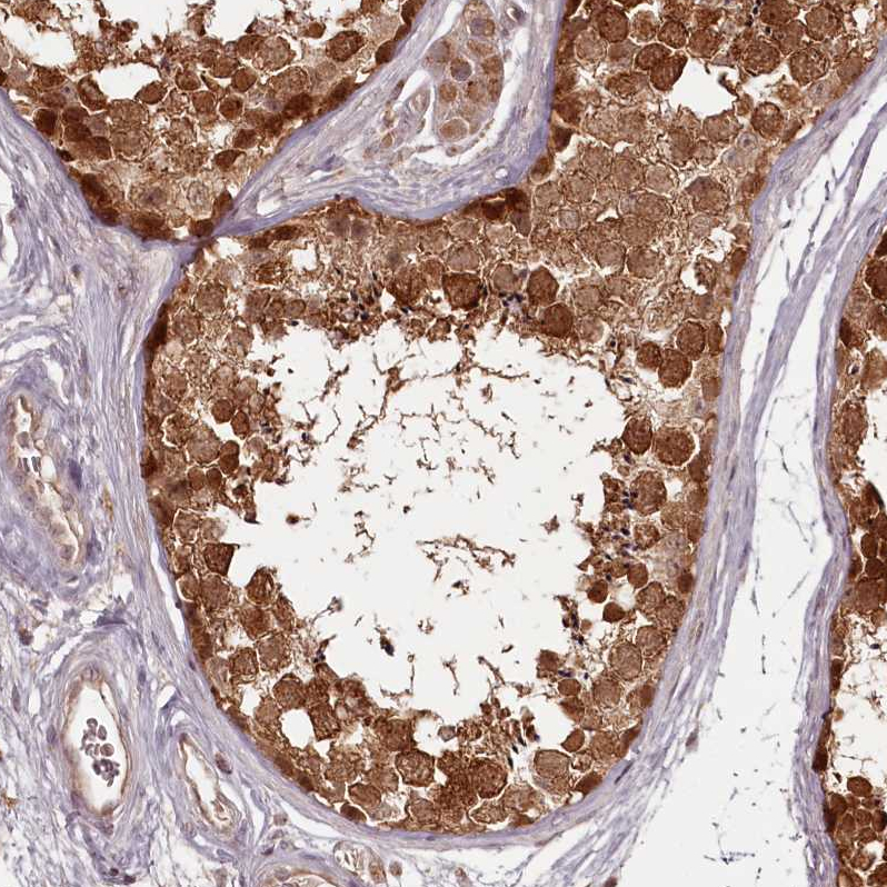 PCBP2 Antibody - BSA Free Immunohistochemistry-Paraffin: PCBP2 Antibody - BSA Free [NBP1-83241]