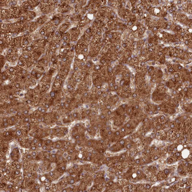 PCBP2 Antibody - BSA Free Immunohistochemistry-Paraffin: PCBP2 Antibody - BSA Free [NBP1-83241]