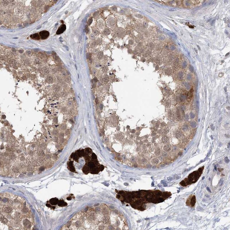 HMGCS1 Antibody - BSA Free Immunohistochemistry-Paraffin: HMGCS1 Antibody - BSA Free [NBP1-83246]