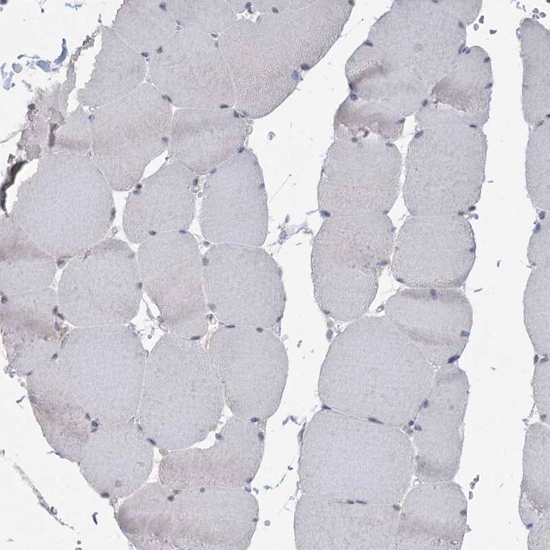 HMGCS1 Antibody - BSA Free Immunohistochemistry-Paraffin: HMGCS1 Antibody - BSA Free [NBP1-83246]