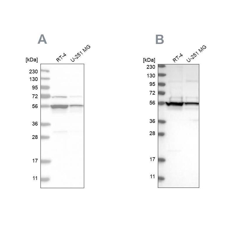 DDX6 Antibody - BSA Free Western Blot: DDX6 Antibody - BSA Free [NBP1-83248]