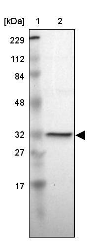 HMGCL Antibody - BSA Free Western Blot: HMGCL Antibody - BSA Free [NBP1-83251]