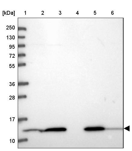 HINT1 Antibody - BSA Free Western Blot: HINT1 Antibody - BSA Free [NBP1-83257]