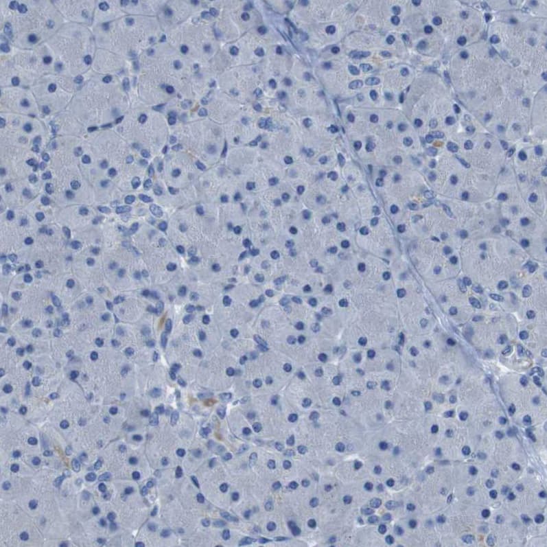 ACCN5 Antibody - BSA Free Immunohistochemistry-Paraffin: ACCN5 Antibody - BSA Free [NBP1-83258]
