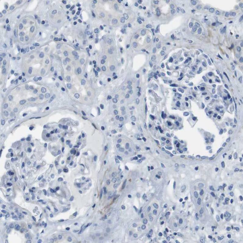 ACCN5 Antibody - BSA Free Immunohistochemistry-Paraffin: ACCN5 Antibody - BSA Free [NBP1-83258]