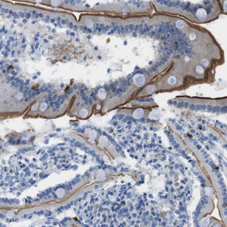ACCN5 Antibody - BSA Free Immunohistochemistry-Paraffin: ACCN5 Antibody - BSA Free [NBP1-83258]