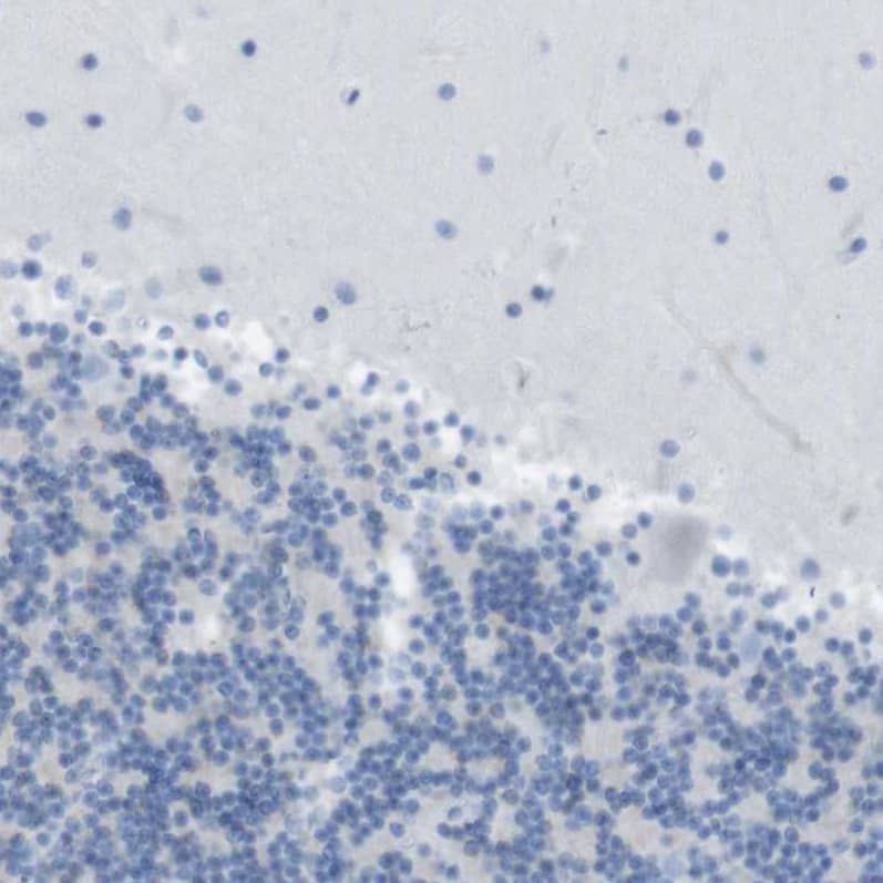 ACCN5 Antibody - BSA Free Immunohistochemistry-Paraffin: ACCN5 Antibody - BSA Free [NBP1-83258]