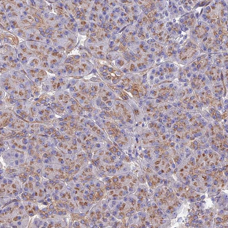 GPR113 Antibody - BSA Free Immunohistochemistry-Paraffin: GPR113 Antibody - BSA Free [NBP1-83262]