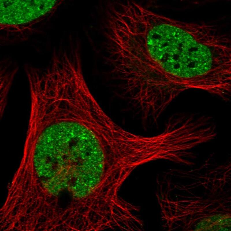 SAFB Antibody - BSA Free Immunocytochemistry/ Immunofluorescence: SAFB Antibody [NBP1-83265]