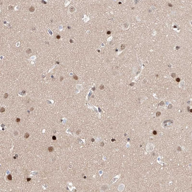 HDAC9 Antibody - BSA Free Immunohistochemistry-Paraffin: HDAC9 Antibody - BSA Free [NBP1-83274]