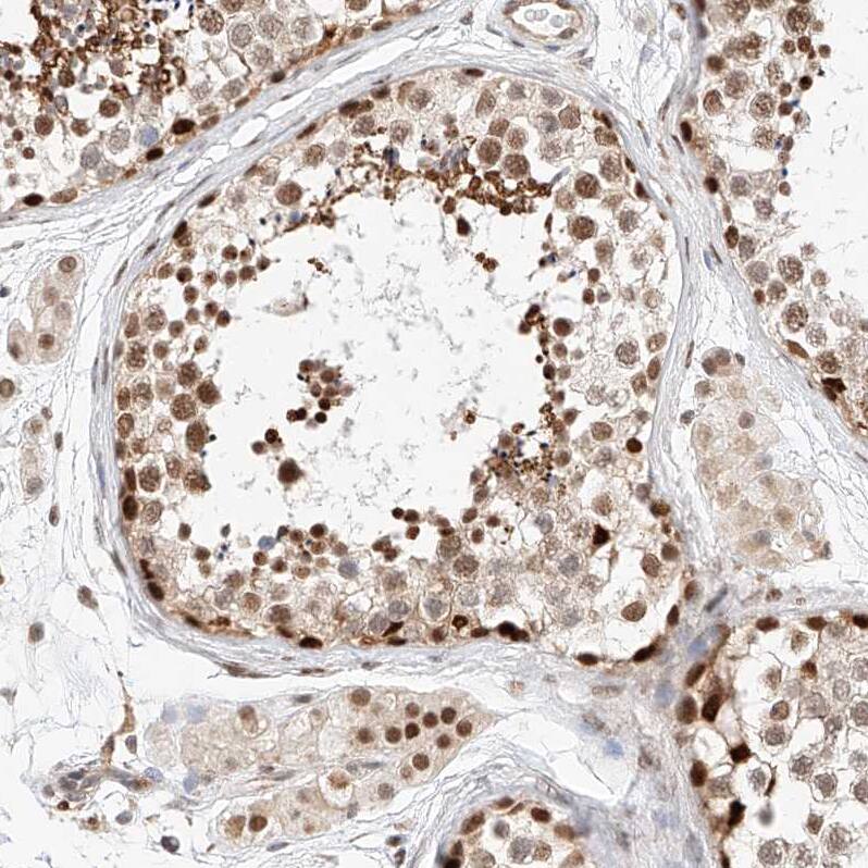 HDAC9 Antibody - BSA Free Immunohistochemistry-Paraffin: HDAC9 Antibody - BSA Free [NBP1-83274]