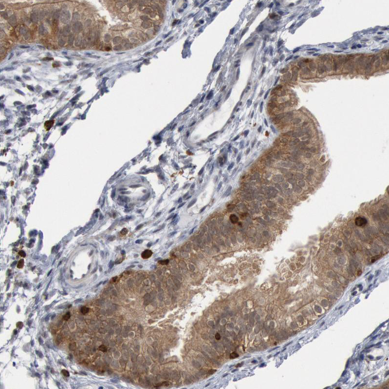 SHP-1 Antibody - BSA Free Immunohistochemistry-Paraffin: SHP-1 Antibody - BSA Free [NBP1-83276]
