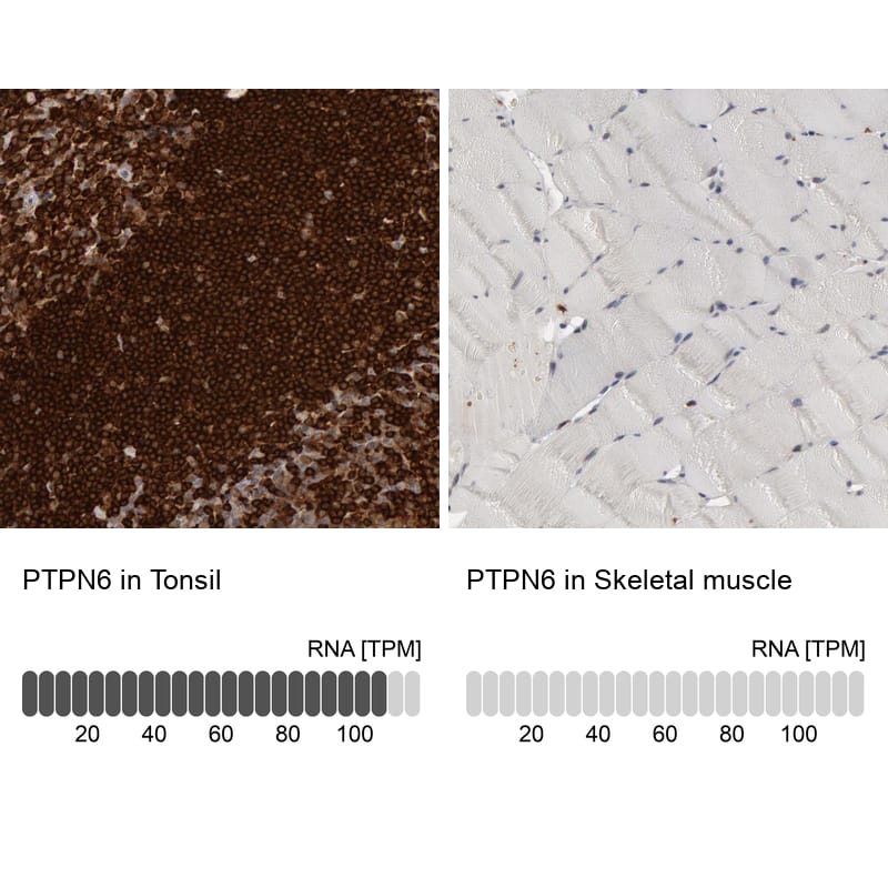 SHP-1 Antibody - BSA Free Immunohistochemistry-Paraffin: SHP-1 Antibody - BSA Free [NBP1-83276]