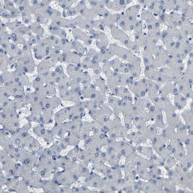 NMES1 Antibody Immunohistochemistry-Paraffin: NMES1 Antibody [NBP2-31996]