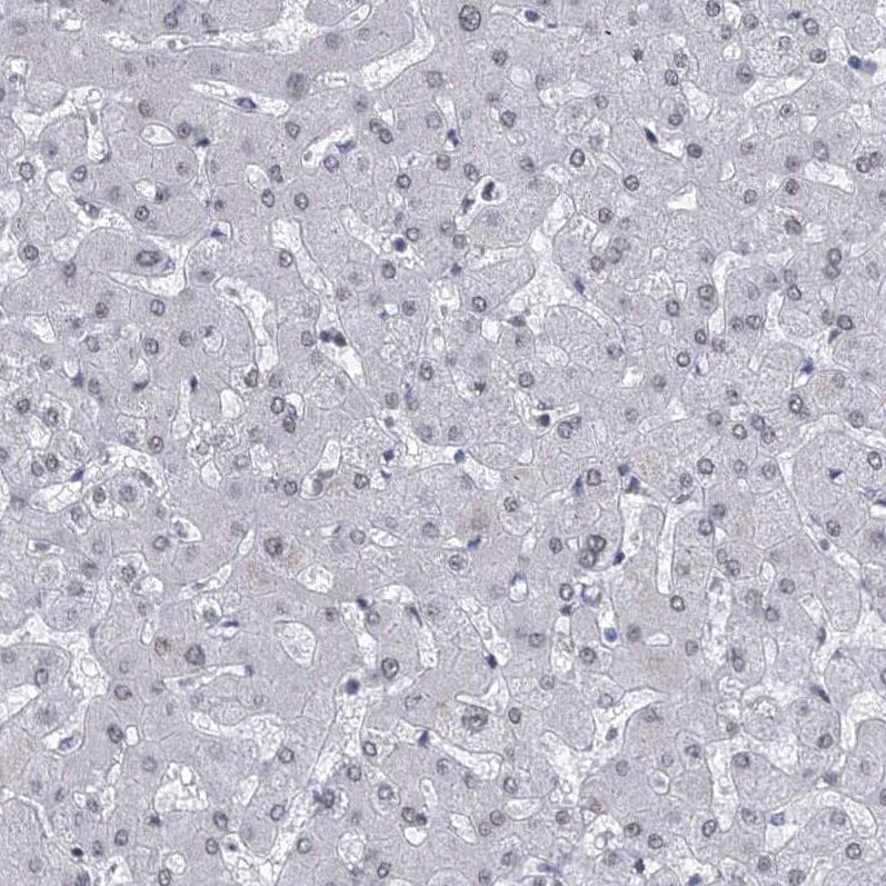 Centrin 2 Antibody Immunohistochemistry-Paraffin: Centrin 2 Antibody [NBP1-88213]