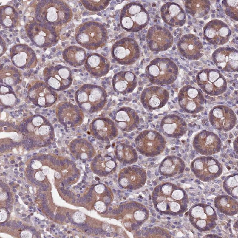 TYW1 Antibody Immunohistochemistry-Paraffin: TYW1 Antibody [NBP2-38503]