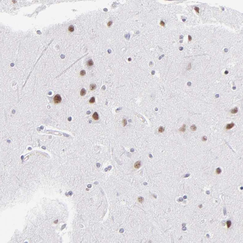 SNRPN Antibody Immunohistochemistry-Paraffin: SNRPN Antibody [NBP1-83280]