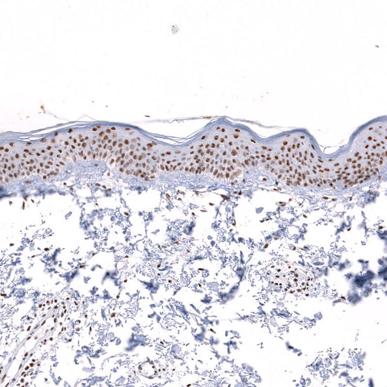 SNRPN Antibody Immunohistochemistry-Paraffin: SNRPN Antibody [NBP1-83280]