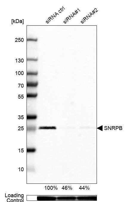 SNRPN Antibody Western Blot: SNRPN Antibody [NBP1-83280]