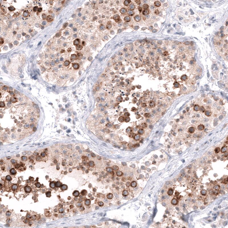 HAI-2/SPINT2 Antibody - BSA Free Immunohistochemistry-Paraffin: HAI-2/SPINT2 Antibody - BSA Free [NBP1-83299]
