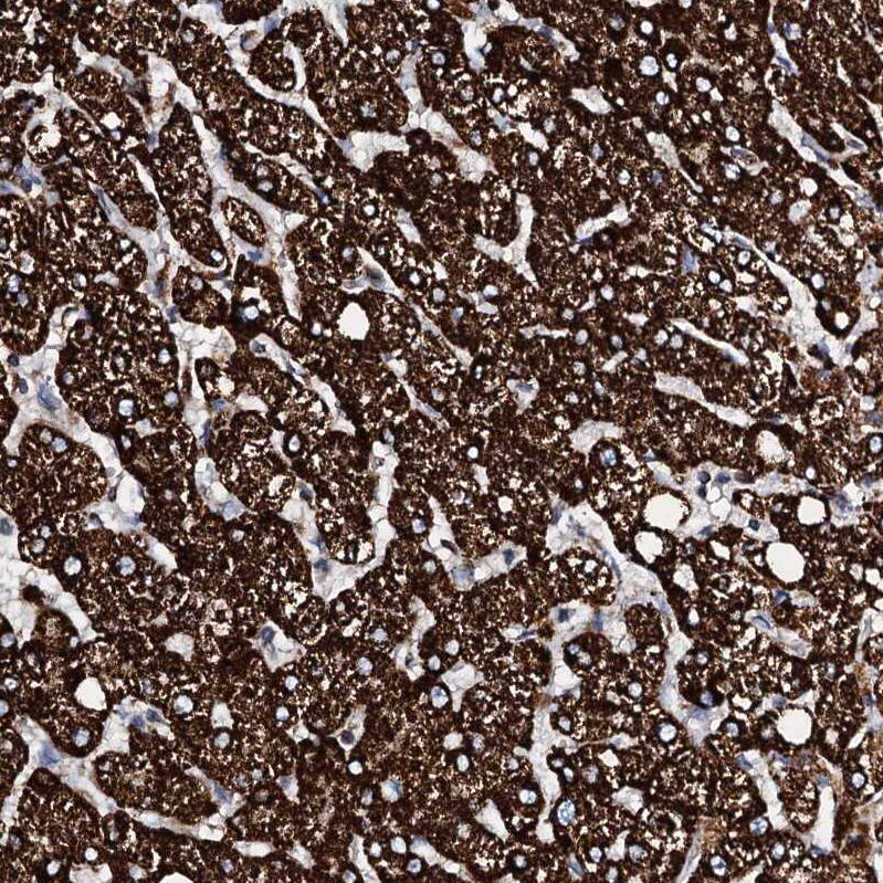 HADH Antibody - BSA Free Immunohistochemistry-Paraffin: HADH Antibody - BSA Free [NBP1-83300]