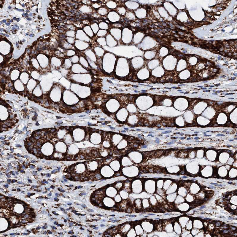 HADH Antibody - BSA Free Immunohistochemistry-Paraffin: HADH Antibody - BSA Free [NBP1-83300]