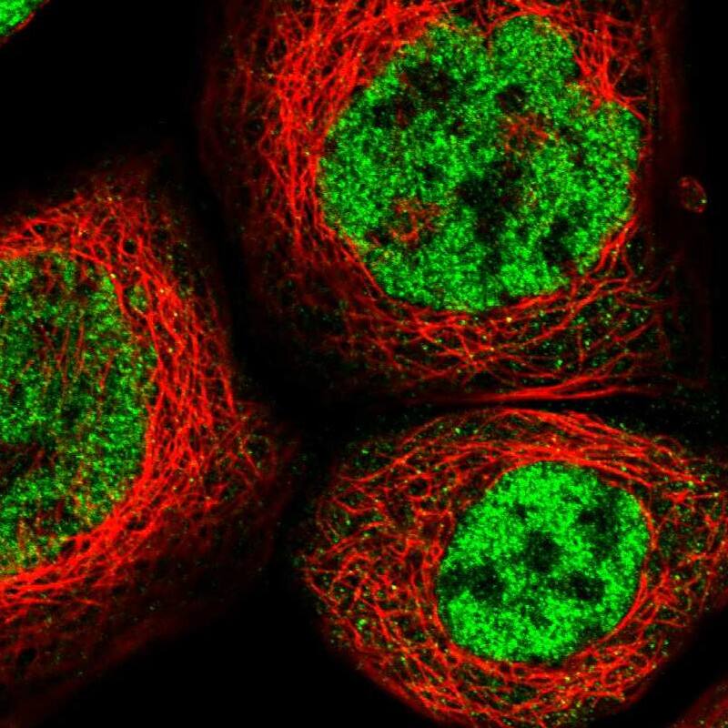 RBM5 Antibody - BSA Free Immunocytochemistry/ Immunofluorescence: RBM5 Antibody [NBP1-83304]