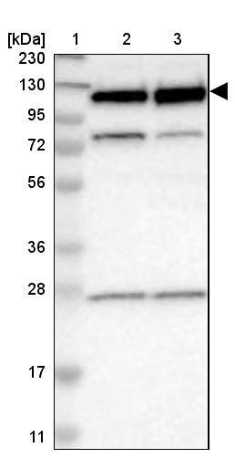 RBM5 Antibody - BSA Free Western Blot: RBM5 Antibody - BSA Free [NBP1-83304]