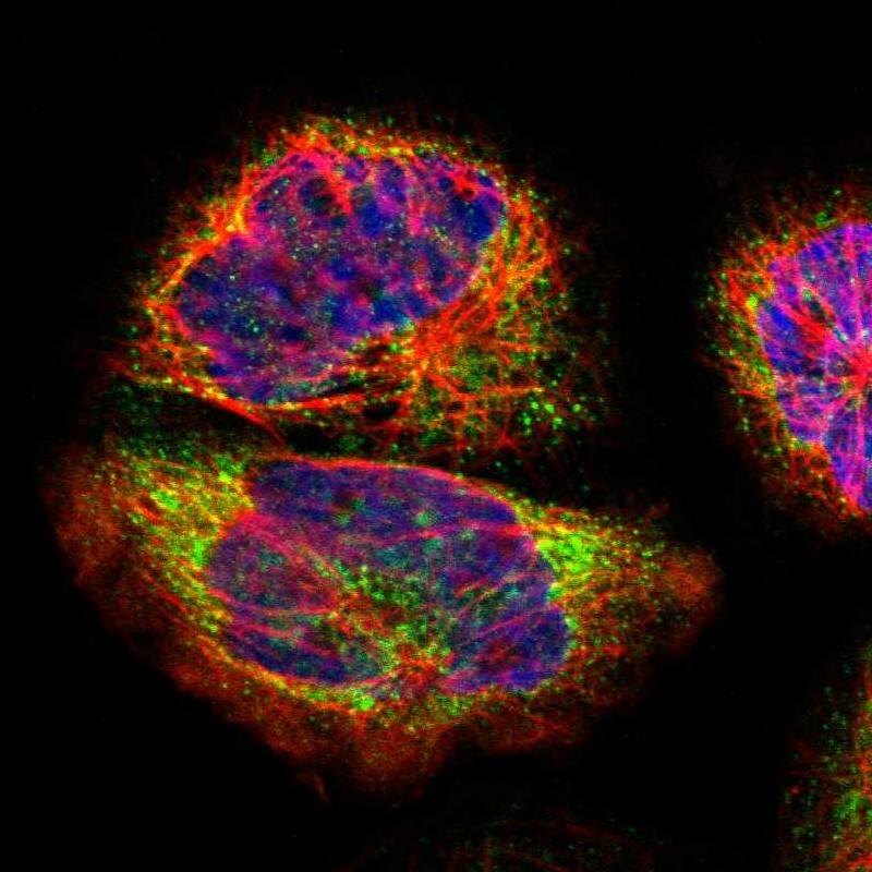 NSDHL Antibody - BSA Free Immunocytochemistry/ Immunofluorescence: NSDHL Antibody [NBP1-83306]