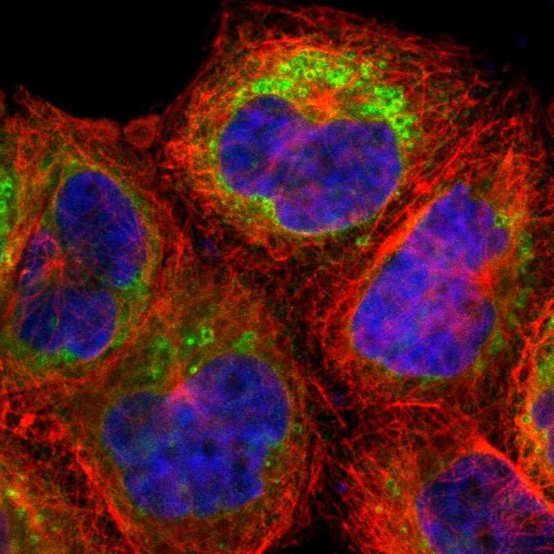 NSDHL Antibody - BSA Free Immunocytochemistry/ Immunofluorescence: NSDHL Antibody [NBP1-83307]