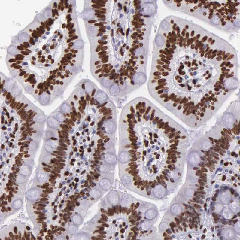 H1F0 Antibody - BSA Free Immunohistochemistry-Paraffin: H1F0 Antibody - BSA Free [NBP1-83308]