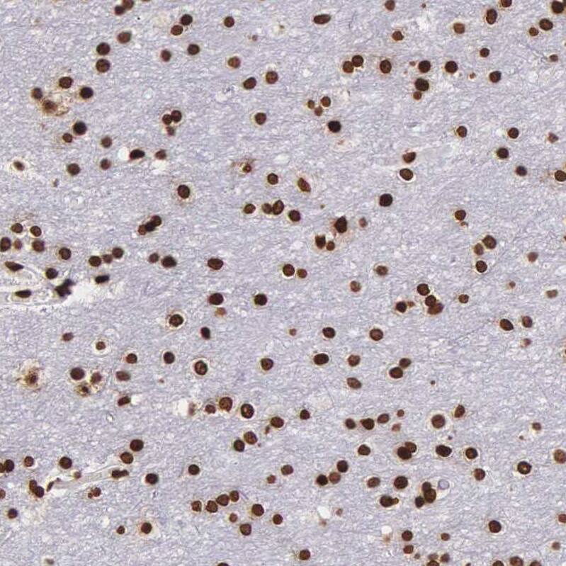 H1F0 Antibody - BSA Free Immunohistochemistry-Paraffin: H1F0 Antibody - BSA Free [NBP1-83308]