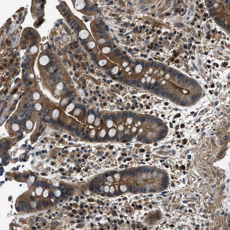 ARHGEF11 Antibody - BSA Free Immunohistochemistry-Paraffin: ARHGEF11 Antibody - BSA Free [NBP1-83312]