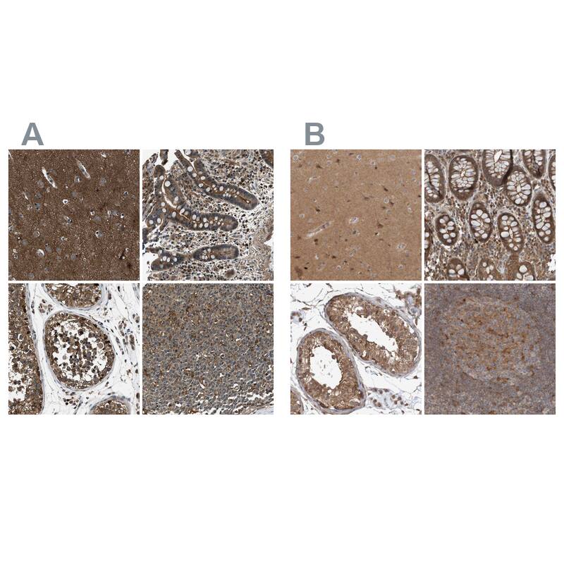 ARHGEF11 Antibody - BSA Free Immunohistochemistry-Paraffin: ARHGEF11 Antibody - BSA Free [NBP1-83312]