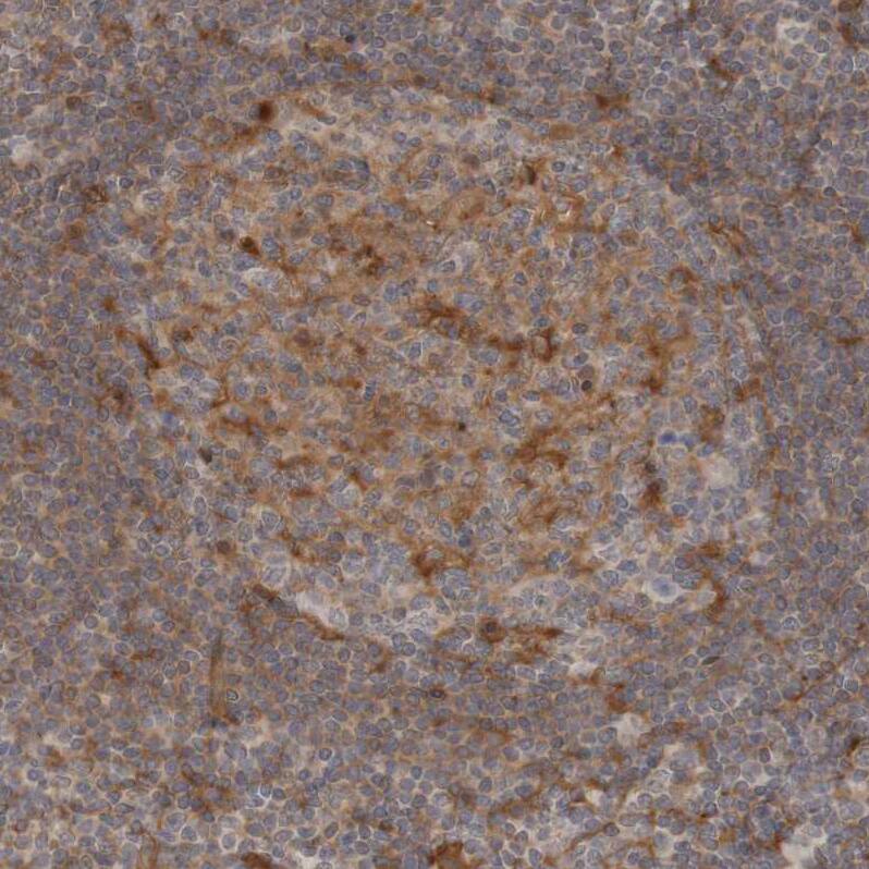 ARHGEF11 Antibody - BSA Free Immunohistochemistry-Paraffin: ARHGEF11 Antibody - BSA Free [NBP1-83314]