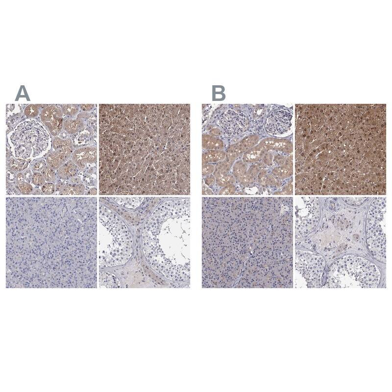 GSTO1 Antibody Immunohistochemistry-Paraffin: GSTO1 Antibody Antibody [NBP1-83321]