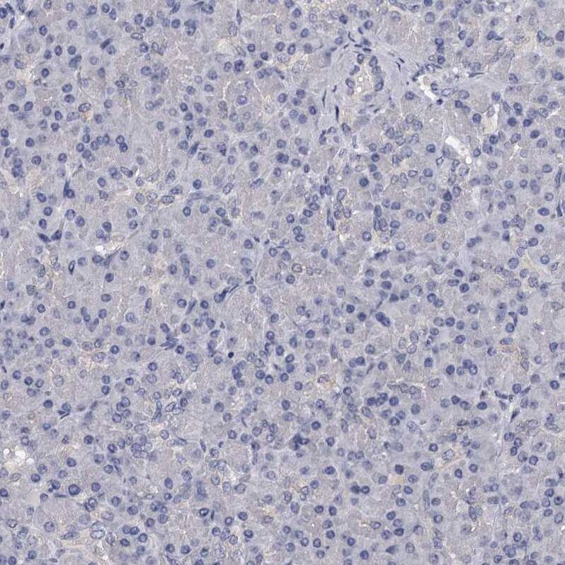 GSTO1 Antibody - BSA Free Immunohistochemistry-Paraffin: GSTO1 Antibody - BSA Free [NBP1-83321]