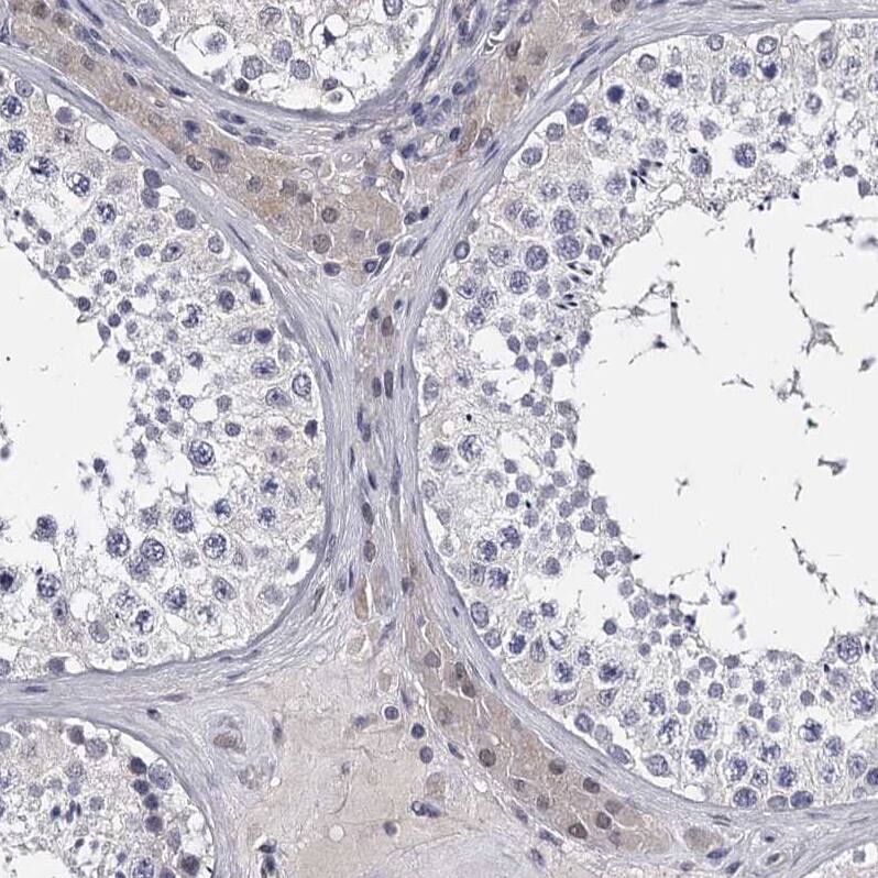 GSTO1 Antibody - BSA Free Immunohistochemistry-Paraffin: GSTO1 Antibody - BSA Free [NBP1-83321]