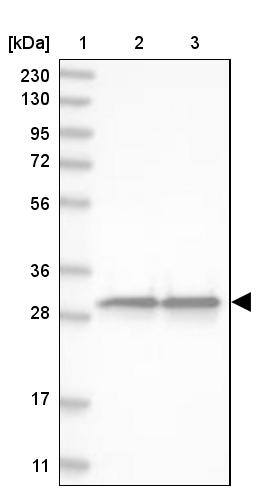 GSTO1 Antibody - BSA Free Western Blot: GSTO1 Antibody - BSA Free [NBP1-83321]