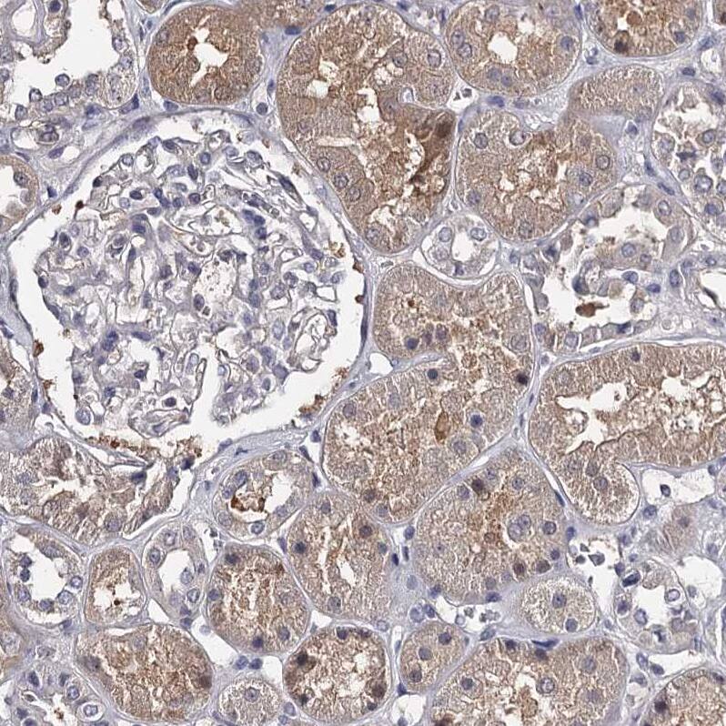 GSTO1 Antibody - BSA Free Immunohistochemistry-Paraffin: GSTO1 Antibody - BSA Free [NBP1-83321]