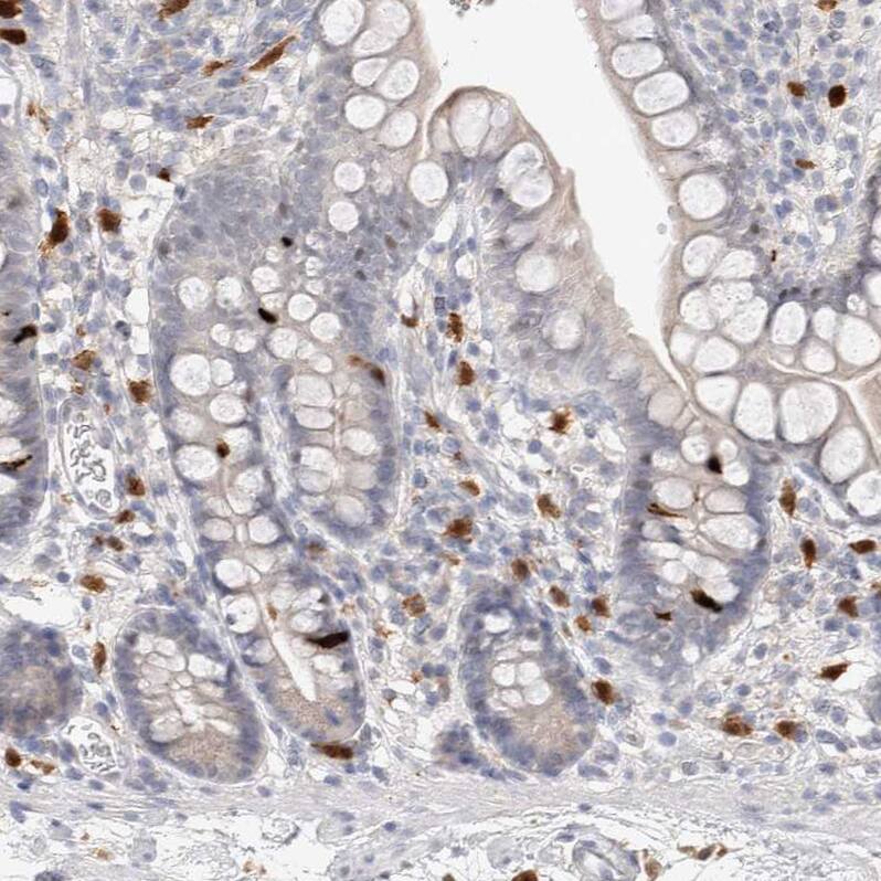 Hematopoietic Prostaglandin D Synthase/HPGDS Antibody - BSA Free Immunohistochemistry-Paraffin: Hematopoietic Prostaglandin D Synthase/HPGDS Antibody [NBP1-83322]