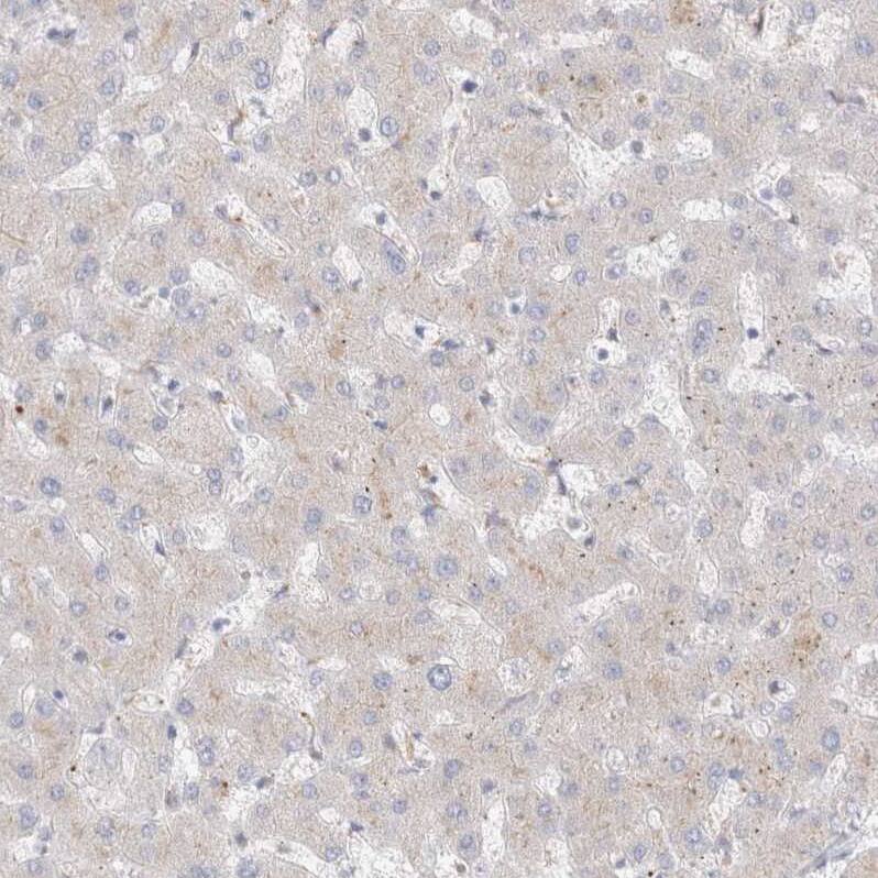 Hematopoietic Prostaglandin D Synthase/HPGDS Antibody - BSA Free Immunohistochemistry-Paraffin: Hematopoietic Prostaglandin D Synthase/HPGDS Antibody [NBP1-83322]