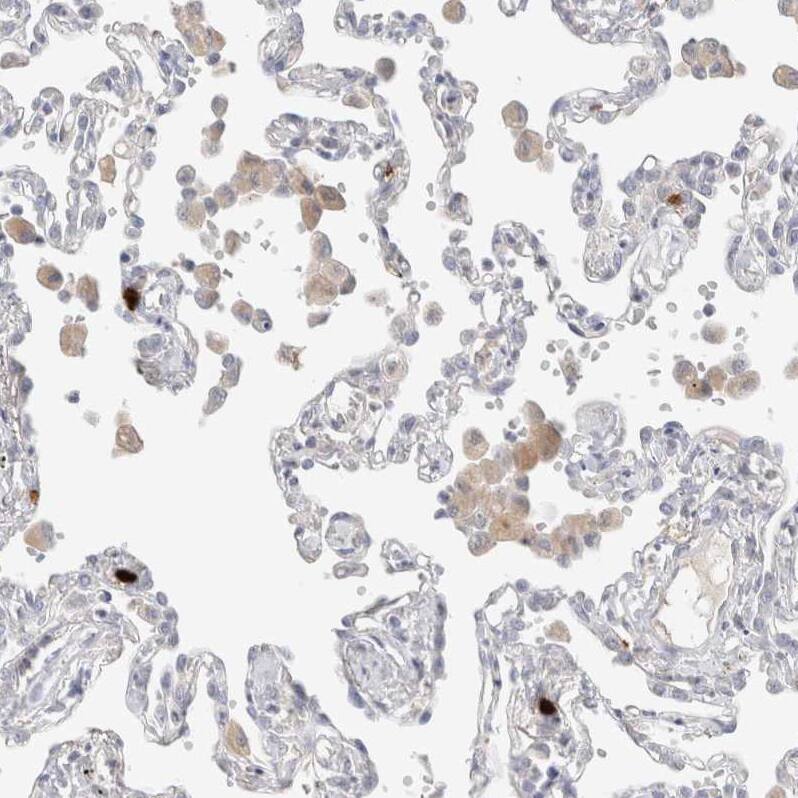 Hematopoietic Prostaglandin D Synthase/HPGDS Antibody - BSA Free Immunohistochemistry-Paraffin: Hematopoietic Prostaglandin D Synthase/HPGDS Antibody [NBP1-83322]