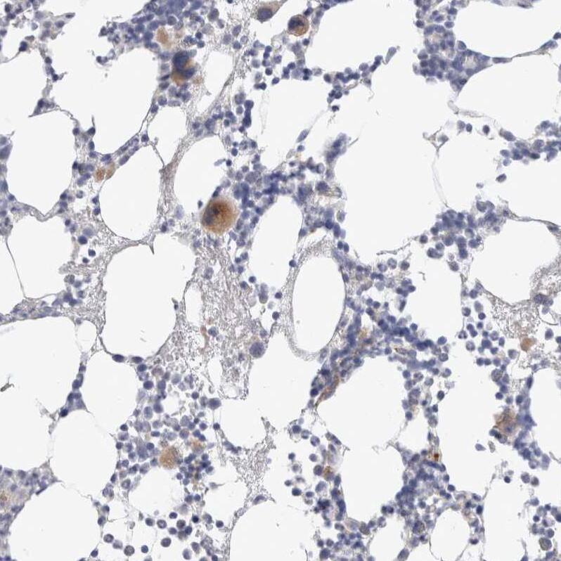 Hematopoietic Prostaglandin D Synthase/HPGDS Antibody - BSA Free Immunohistochemistry-Paraffin: Hematopoietic Prostaglandin D Synthase/HPGDS Antibody [NBP1-83322]