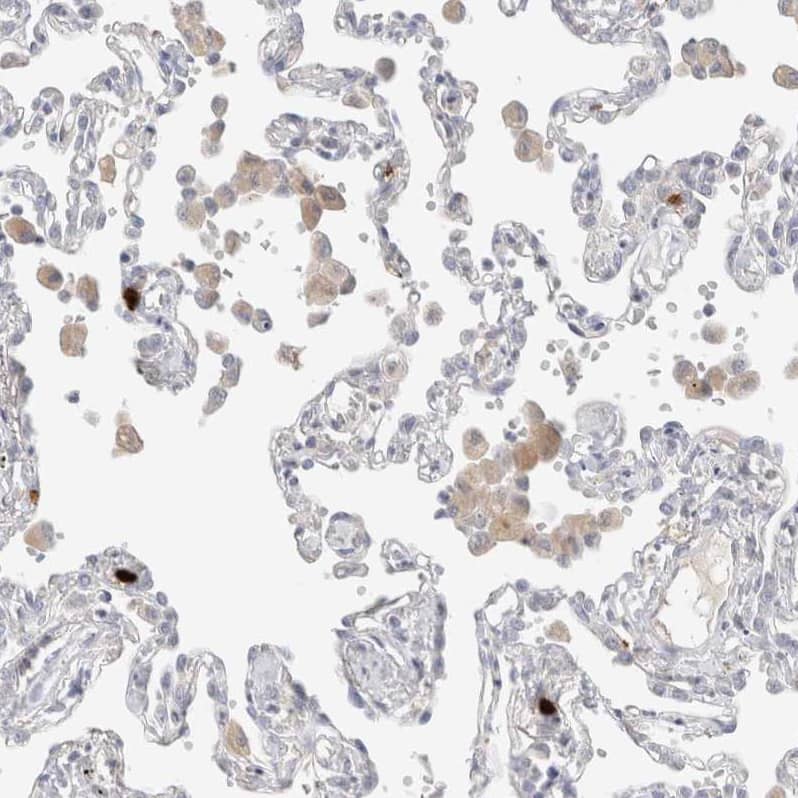 Hematopoietic Prostaglandin D Synthase/HPGDS Antibody - BSA Free Immunohistochemistry-Paraffin: Hematopoietic Prostaglandin D Synthase/HPGDS Antibody - BSA Free [NBP1-83322]