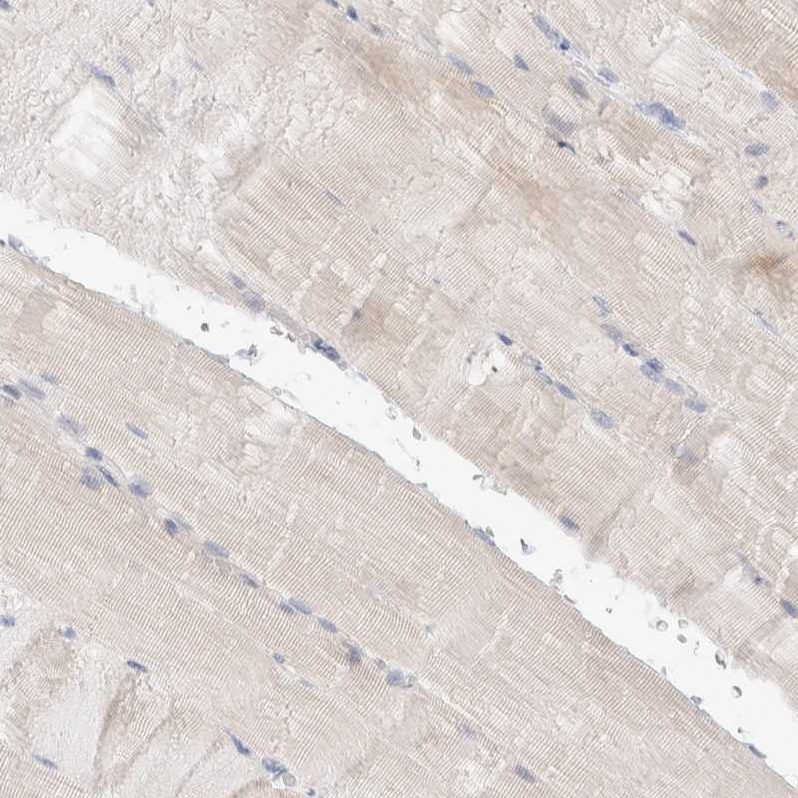 Hematopoietic Prostaglandin D Synthase/HPGDS Antibody - BSA Free Immunohistochemistry-Paraffin: Hematopoietic Prostaglandin D Synthase/HPGDS Antibody - BSA Free [NBP1-83322]