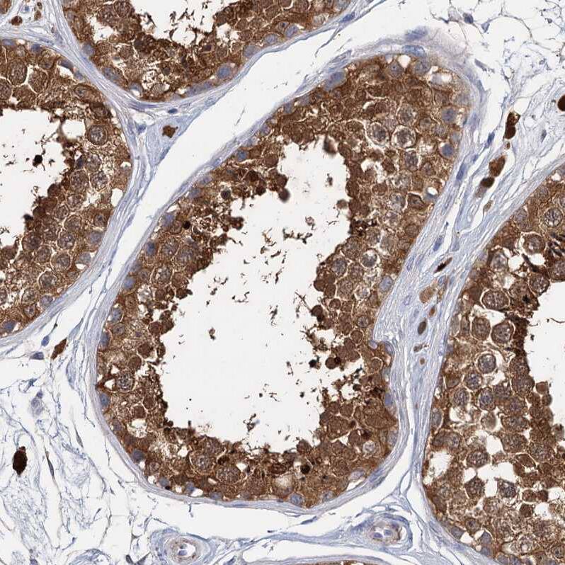 GSTM3 Antibody - BSA Free Immunohistochemistry-Paraffin: GSTM3 Antibody - BSA Free [NBP1-83323]