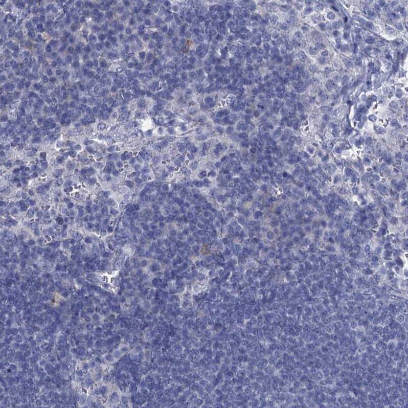 GSTM3 Antibody - BSA Free Immunohistochemistry-Paraffin: GSTM3 Antibody - BSA Free [NBP1-83323]